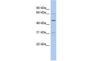 WB Suggested Anti-ZNF641 Antibody Titration:  0. (ZNF641 anticorps  (Middle Region))