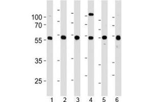 YY1 antibody western blot analysis in 1) 293, 2) HL-60, 3) SiHa, 4) K562, 5) THP-1 and 6) U266 lysate. (YY1 anticorps  (AA 74-104))