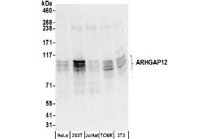 anti-rho GTPase Activating Protein 12 (ARHGAP12) (AA 100-150) antibody