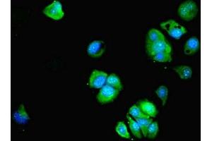 Immunofluorescent analysis of MCF-7 cells using ABIN7145831 at dilution of 1:100 and Alexa Fluor 488-congugated AffiniPure Goat Anti-Rabbit IgG(H+L)