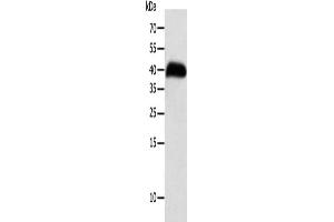 Gel: 10 % SDS-PAGE, Lysate: 40 μg, Lane: Human thigh malignant fibrous histiocytoma tissue, Primary antibody: ABIN7131272(SYT5 Antibody) at dilution 1/100, Secondary antibody: Goat anti rabbit IgG at 1/8000 dilution, Exposure time: 8 hours (Synaptotagmin V anticorps)