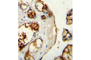 Immunohistochemical staining of formalin-fixed and paraffin-embedded human placenta tissue reacted with TNK1 monoclonal antibody  at 1:50-1:100 dilution. (TNK1 anticorps)