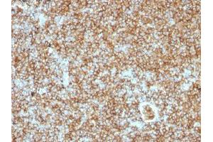 Image no. 2 for anti-CD45RB (CD45RB) antibody (ABIN6170687) (CD45RB anticorps)