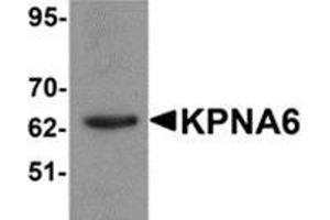 Western blot analysis of KPNA6 in 293 cell lysate with KPNA6 antibody at 1 μg/ml. (KPNA6 anticorps  (N-Term))