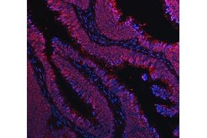IF analysis of TIP49A/RUVBL1 using anti-TIP49A/RUVBL1 antibody (ABIN7599928). (RUVBL1 anticorps  (AA 13-23))
