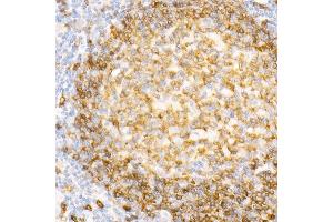 Immunohistochemistry of paraffin-embedded Human tonsil using CD79a antibody (ABIN7265805) at dilution of 1:100 (40x lens).