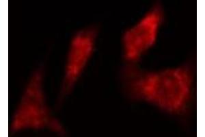 ABIN6277985 staining  Hela cells by IF/ICC. (CDC6 anticorps)