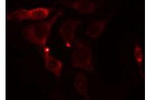 ABIN6275489 staining NIH-3T3 cells by IF/ICC. (ARHGAP11A anticorps  (C-Term))