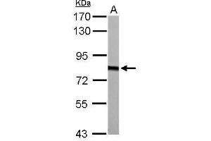 WB Image HADHA antibody detects HADHA protein by Western blot analysis.