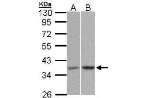 WB Image Sample (30 ug of whole cell lysate) A: 293T B: Molt-4 , 10% SDS PAGE antibody diluted at 1:1500 (PPP2CA anticorps  (C-Term))