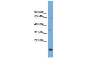 Image no. 1 for anti-Solute Carrier Family 25, Member 44 (SLC25A44) (C-Term) antibody (ABIN6745599) (SLC25A44 anticorps  (C-Term))
