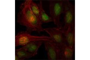Immunofluorescence analysis of Hela cells using ZBTB7B antibody (green). (ZBTB7B anticorps)