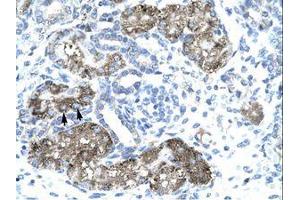 Image no. 1 for anti-General Transcription Factor IIH, Polypeptide 1, 62kDa (GTF2H1) (N-Term) antibody (ABIN202744)