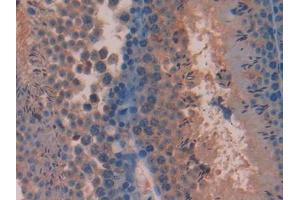 DAB staining on IHC-P; Samples: Mouse Testis Tissue (Pituitary Adenylate Cyclase Activating Peptide (AA 1-175) anticorps)