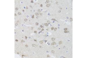 Immunohistochemistry of paraffin-embedded rat brain using PPP1CC antibody at dilution of 1:100 (x40 lens).