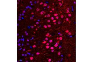 Immunofluorescence of paraffin embedded rat brain using NSD3 (ABIN7076233) at dilution of 1:650 (400x lens) (WHSC1L1 anticorps)
