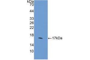 Western blot analysis of recombinant Human DHH. (desert Hedgehog anticorps  (AA 241-383))