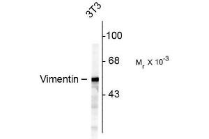 Image no. 1 for anti-Vimentin (VIM) antibody (ABIN372741) (Vimentin anticorps)