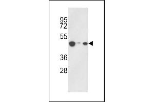 Western blot analysis of hHAT1- (ABIN387932 and ABIN2844437) in 293, HepG2, Jurkat cell line lysates (35 μg/lane). (HAT1 anticorps  (C-Term))