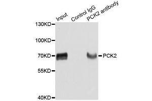 Immunoprecipitation analysis of extracts of HepG2 cells using PCK2 antibody.