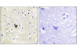 Immunohistochemistry analysis of paraffin-embedded human brain tissue, using PKD2 (Ab-876) Antibody. (PKD2 anticorps  (AA 829-878))