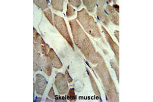 Formalin-fixed and paraffin-embedded human skeletal musclereacted with CKM polyclonal antibody , which was peroxidase-conjugated to the secondary antibody, followed by AEC staining. (CKM anticorps  (C-Term))