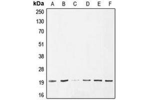 Western blot analysis of BAX expression in HeLa (A), A549 (B), A375 (C), Jurkat (D), HepG2 (E), PC12 (F) whole cell lysates. (BAX anticorps  (Center))