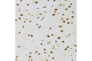 Immunohistochemistry of paraffin-embedded rat brain using CSRP3 Antibody (ABIN2562048) at dilution of 1:100 (40x lens). (CSRP3 anticorps)
