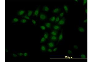 anti-Tripartite Motif Containing 33 (TRIM33) (AA 1006-1105) antibody