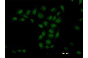 Immunofluorescence of monoclonal antibody to TRIM33 on HeLa cell. (TRIM33 anticorps  (AA 1006-1105))