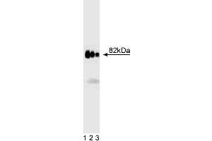 Western blot analysis of AKAP82 on rat testis lysate. (AKAP4 anticorps  (AA 555-675))