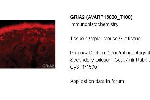 Immunohistochemistry (IHC) image for anti-Glutamate Receptor, Ionotropic, AMPA 2 (GRIA2) (N-Term) antibody (ABIN2792285) (GRIA2 anticorps  (N-Term))