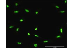 Immunofluorescence of purified MaxPab antibody to ADAR on HeLa cell. (ADAR anticorps  (AA 1-1226))