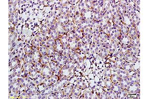 Formalin-fixed and paraffin embedded: rat kidney tissue labeled with Anti-GLUT4 Polyclonal Antibody (ABIN739445), Unconjugated at 1:200, followed by conjugation to the secondary antibody and DAB staining (GLUT4 anticorps  (AA 401-509))