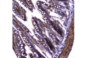 IHC testing of FFPE rat small intestine tissue with Dynamin 1 antibody at 1ug/ml. (Dynamin 1 anticorps)
