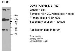 Image no. 4 for anti-DEAD (Asp-Glu-Ala-Asp) Box Polypeptide 1 (DDX1) (Middle Region) antibody (ABIN2775202)