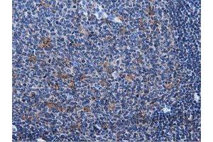 Immunohistochemical staining of paraffin-embedded Human lymph node tissue using anti-MICAL1 mouse monoclonal antibody. (MICAL1 anticorps)