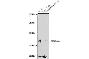 Immunoprecipitation analysis of 200 μg extracts of HeLa cells, using 3 μg PPP1R12A antibody (ABIN6128260, ABIN6146059, ABIN6146061 and ABIN6213896).