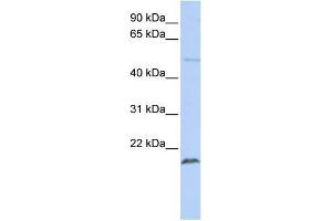 Human Jurkat; WB Suggested Anti-ZNF79 Antibody Titration: 0. (ZNF79 anticorps  (N-Term))