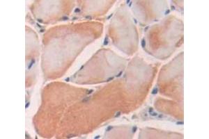 Used in DAB staining on fromalin fixed paraffin- embedded Kidney tissue