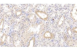 Detection of TFPI in Human Kidney Tissue using Polyclonal Antibody to Tissue Factor Pathway Inhibitor (TFPI)