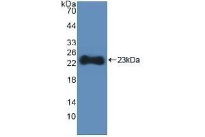 Detection of Recombinant HMGCS, Human using Polyclonal Antibody to Hydroxymethylglutaryl Coenzyme A Synthase (HMGCS)