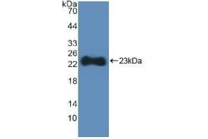 Detection of Recombinant HMGCS, Human using Polyclonal Antibody to Hydroxymethylglutaryl Coenzyme A Synthase (HMGCS) (HMGCS1 anticorps  (AA 293-467))