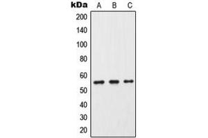 Western blot analysis of Cytochrome P450 2C9 expression in HeLa (A), Raw264. (CYP2C9 anticorps  (Center))