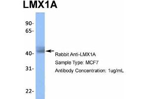 Host:  Rabbit  Target Name:  LMX1A  Sample Type:  MCF7  Antibody Dilution:  1. (LMX1A anticorps  (Middle Region))