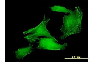Immunofluorescence of purified MaxPab antibody to PDLIM7 on HeLa cell. (PDLIM7 anticorps  (AA 1-457))