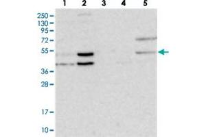 Western blot analysis of Lane 1: RT-4, Lane 2: U-251 MG, Lane 3: Human Plasma, Lane 4: Liver, Lane 5: Tonsil with NSMCE4A polyclonal antibody  at 1:250-1:500 dilution.