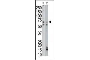 The anti-PCK1 Pab (ABIN1882180 and ABIN2842170) is used in Western blot to detect PCK1 in mouse liver (Lane 1) and mouse small intestine tissue lysates (Lane 2). (PCK1 anticorps  (C-Term))