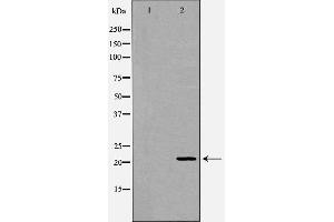 Western blot analysis of Mouse liver tissue lysates, using FTH1 Antibody. (FTH1 anticorps  (C-Term))