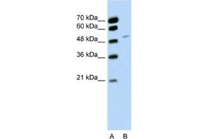 Western Blotting (WB) image for anti-RNA Binding Motif Protein 22 (RBM22) antibody (ABIN2462277) (RBM22 anticorps)